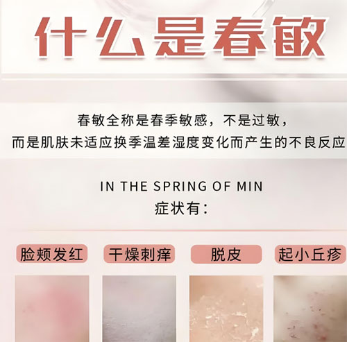 春敏是什么？如何有效預防春敏？